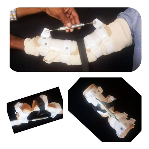 Forearm splint Up To Elbow (External) Manufacturer & Supplier | India